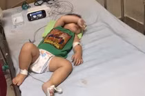 3 chị em ở Hà Nội tử vong vì nhiễm vi khuẩn "ăn thịt người"