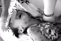 Nhũ nhi mắc thủy đậu từ người đến thăm