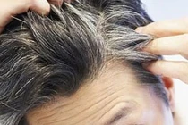 Bạc tóc vì stress