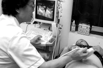 Mổ đẻ đã 4 năm mà tử cung vẫn còn dịch?