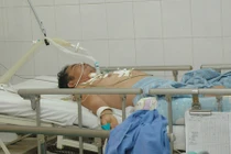 Xử lý tư thế liệt cứng ở người sau tai biến