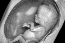 Cách phát hiện sớm bệnh ở thai nhi 