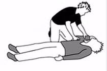 Biểu hiện của động kinh