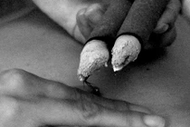 Cứu ngải chữa ra mồ hôi tay