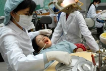 Nhổ răng vẩu có gây yếu răng?