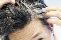 Hà thủ ô, đậu đen điều trị chứng bạc tóc