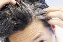 Hà thủ ô, đậu đen điều trị chứng bạc tóc