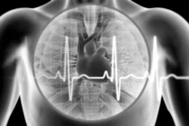 Nhận biết tim đập khoẻ và yếu