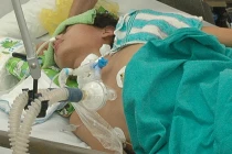 Phân biệt lao màng não với viêm màng não