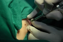 Nhận biết ung thư tế bào đáy ở người cao tuổi