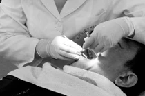 Răng xấu, có nên đi dán răng sứ Veneer?