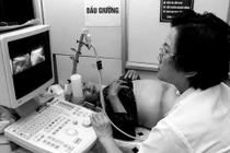 Thai nhi 5 tháng siêu âm 4D không kết quả