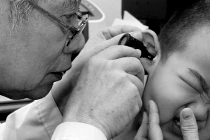 Viêm tai giữa cấp hoại tử sau mắc sởi