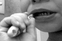 Phải mổ do nuốt bàn chải đánh răng