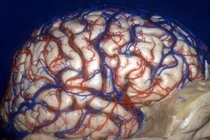 Hình ảnh 3D rùng rợn về não