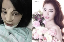 9X “đập mặt đi xây lại” vì sợ chồng chê giờ ra sao?