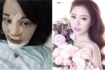 9X “đập mặt đi xây lại” vì sợ chồng chê giờ ra sao?