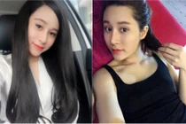 Dao kéo 8 lần, cô gái 9X vẫn mơ về khuôn mặt cũ