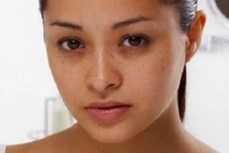 Tình trạng gương mặt tiết lộ sức khỏe