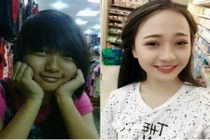 Khoe ảnh sau phẫu thuật thẩm mỹ, 9X bị vu oan làm “gái“