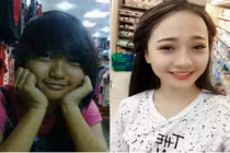 Khoe ảnh sau phẫu thuật thẩm mỹ, 9X bị vu oan làm “gái“