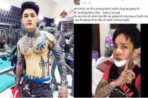 Hot boy xăm trổ thích khoe tiền bị giang hồ đập vỡ mặt?