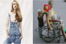 Cô gái từng bị đánh què chân trở thành siêu mẫu nổi tiếng