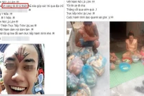 Thanh niên tẩm xăng nhảy cầu và lời hứa đi làm từ thiện