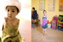 Em bé không tay xinh như thiên thần ngày ấy - bây giờ 