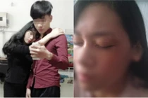 Nữ sinh Bắc Giang “tố” bị bạn trai chặn đánh sau chia tay