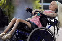 Cô gái bị liệt ôm mộng “biến hình” thành búp bê Barbie