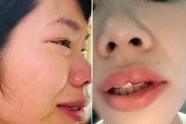 Đắk Nông chỉ đạo xử lý nghiêm vụ cô giáo bị hành hung