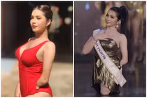 Nghị lực phi thường của người đẹp cụt 2 chân, 1 tay mới thi hoa hậu