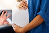 Bệnh tay chân miệng có gây rủi ro cho thai kỳ?