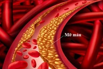 Đồ uống quen thuộc này tránh dùng nhiều kẻo khiến máu “đặc như cháo”