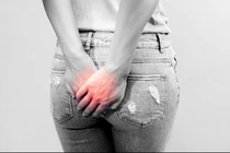 Ngứa ngáy vùng hậu môn, cô gái trẻ hết hồn khi biết nguyên nhân