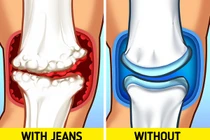 Diện jeans bó sát, người mặc khổ vì “phá” dáng, “đầu độc” sức khỏe