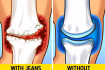 Diện jeans bó sát, người mặc khổ vì “phá” dáng, “đầu độc” sức khỏe