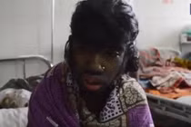 Clip cô bé người sói 12 tuổi gây chấn động