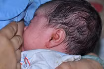 Kinh hãi phát hiện giòi trong tai trẻ sơ sinh