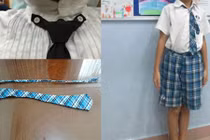 Vụ phụ huynh chê cà vạt của trường: Đừng giận quá mất khôn