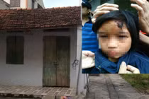 Rúng động Hưng Yên: Bé gái nghi bị hành hạ dã man trong chùa