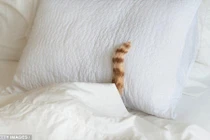 Bác sĩ hốt hoảng gắp cục lông mèo trong...âm đạo 