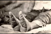 Chiêu hành xác làm đẹp kinh dị nhất lịch sử loài người