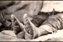 Chiêu hành xác làm đẹp kinh dị nhất lịch sử loài người