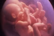 Hình ảnh chật chội của những cặp sinh đôi trong bụng mẹ