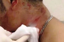 Mâu thuẫn nhỏ, nhóm côn đồ cứa cổ 3 công nhân suýt chết