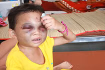 Tạm giữ đôi vợ chồng hành hạ dã man con gái 4 tuổi