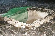 Lọt hố công trình “nghìn tỷ”, một người vỡ thận, đa chấn thương