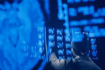 Mỹ sẽ tiên phong hồi sinh người chết?